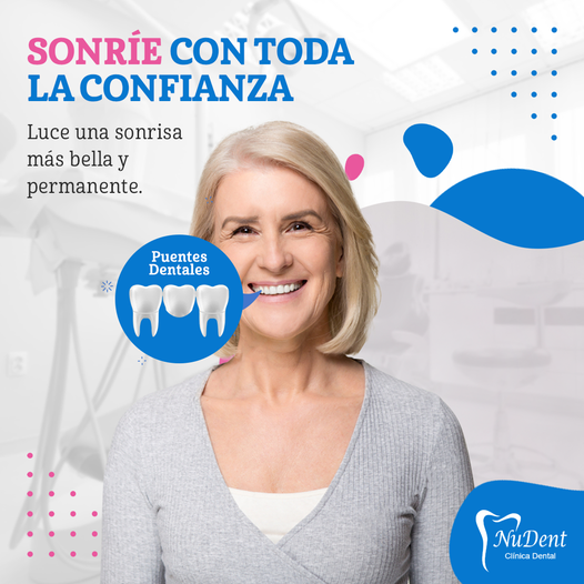 Puentes Dentales Clinica Nudent Trujillo Ortodoncia Implantes Dentales Prótesis Dental 1444