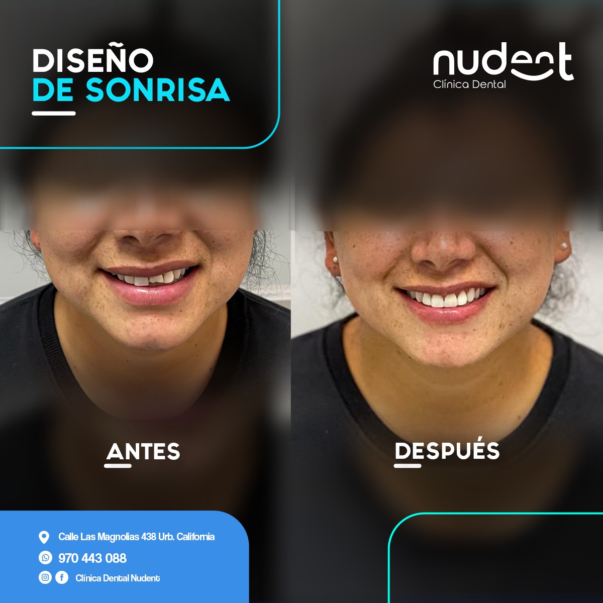 Clínica Dental Nudent Trujillo